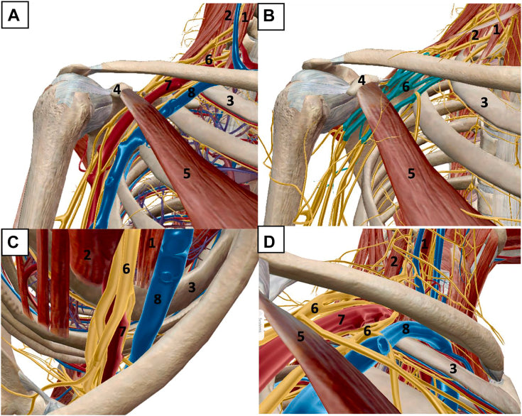 Anatomie van de thoracic outlet in de rechterschouder, weergegeven vanuit vier gezichtspunten. De nummers staan in de bijbehorende legenda.